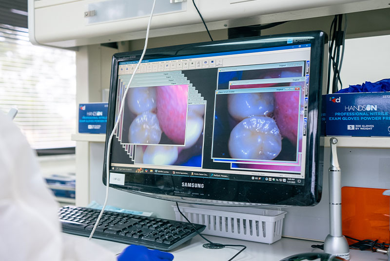 close up of display monitor showcasing technologies for dental treatment
